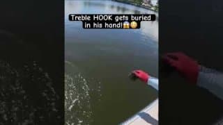 Monster Fish + treble hook gets BURIED in his HAND! #floridafishing